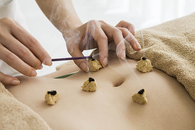Family-friendly acupuncture Pointe-Claire