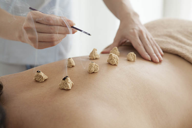 Acupuncteur Pierrefonds
